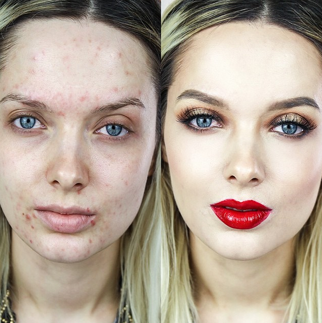 Макияж портит. Макияж на проблемной коже до и после. Девушки до и после макияжа. Девушка с проблемной кожей. Лицо девушки с проблемной кожей.