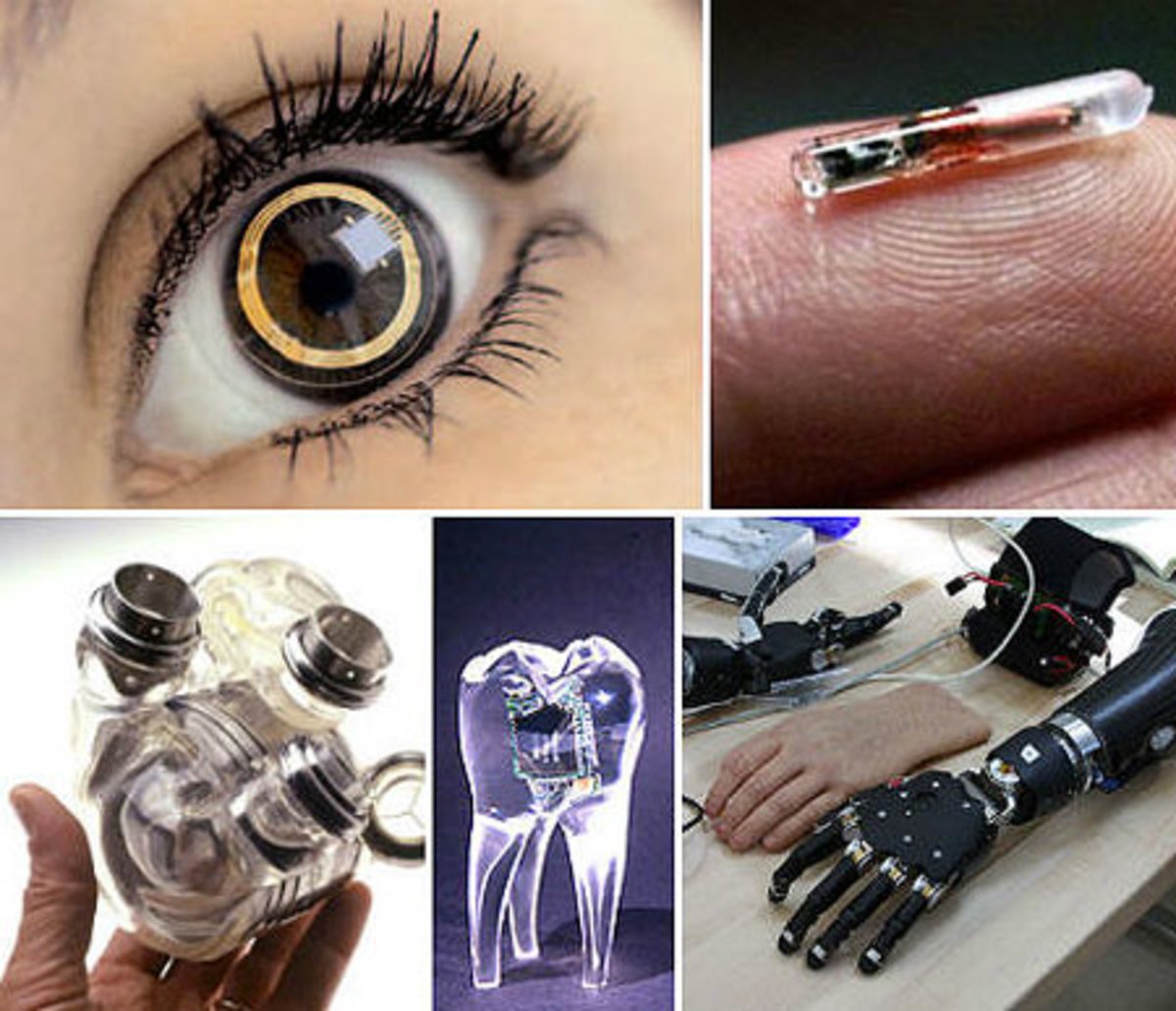 Бионика в медицине. Бионический протез глаза. Искусственный бионический глаз. Бионические изобретения.