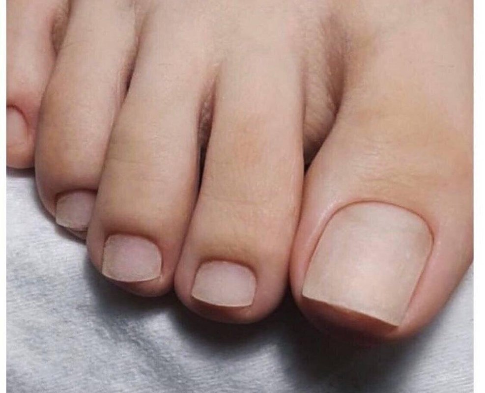 Здоровые ногти на ногах